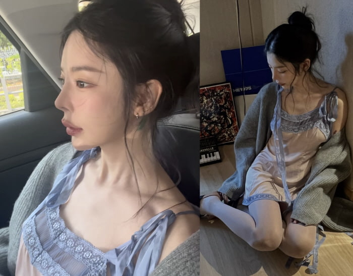 '170cm·48kg' 장재인, 볼살 無·도드라진 흉곽 뼈 '깜짝'…"점점 말라가"